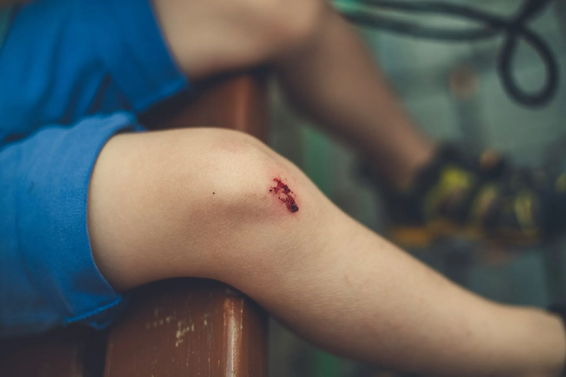 Knie eines Kindes, nach Sturz aufgeschürft